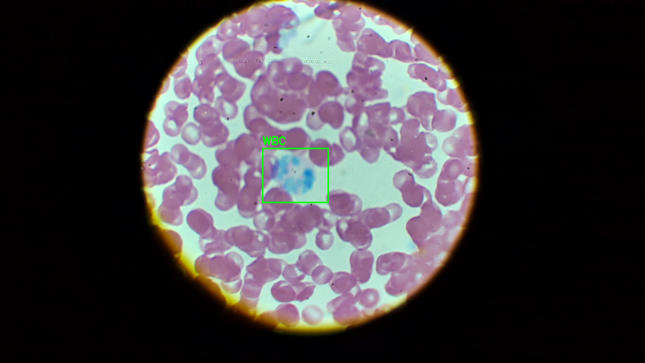 YOLO white blood cell detection result